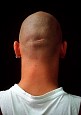 Bonehead